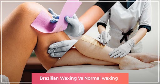 Brazilian Waxing or Normal waxing