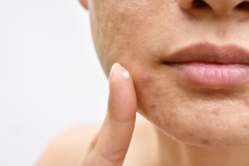 7 Most Common Habits That Are Damaging Your Skin – Yes Madam